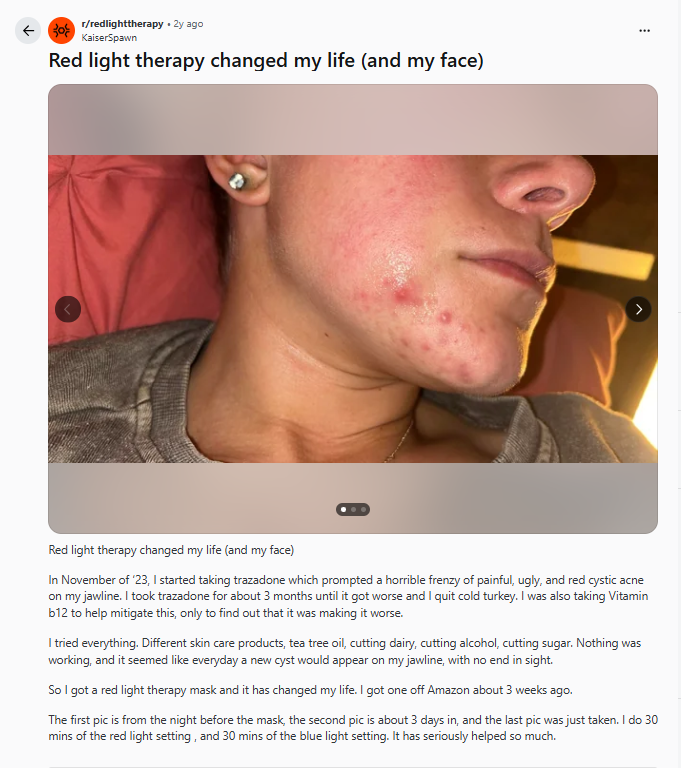 Red light therapy changed my life