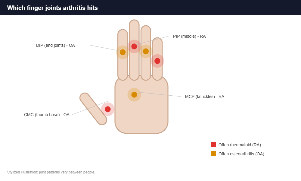 Which finger joints arthritis affects Diagram of which finger joints rheumatoid arthritis and osteoarthritis affect in the hand