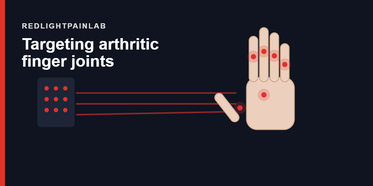 Red Light Therapy for Hand Arthritis Red light therapy for hand arthritis, near-infrared light targeting arthritic finger joints