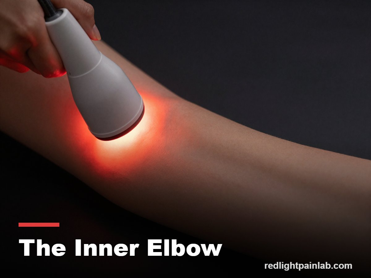 Red light therapy on the inner elbow for golfers elbow