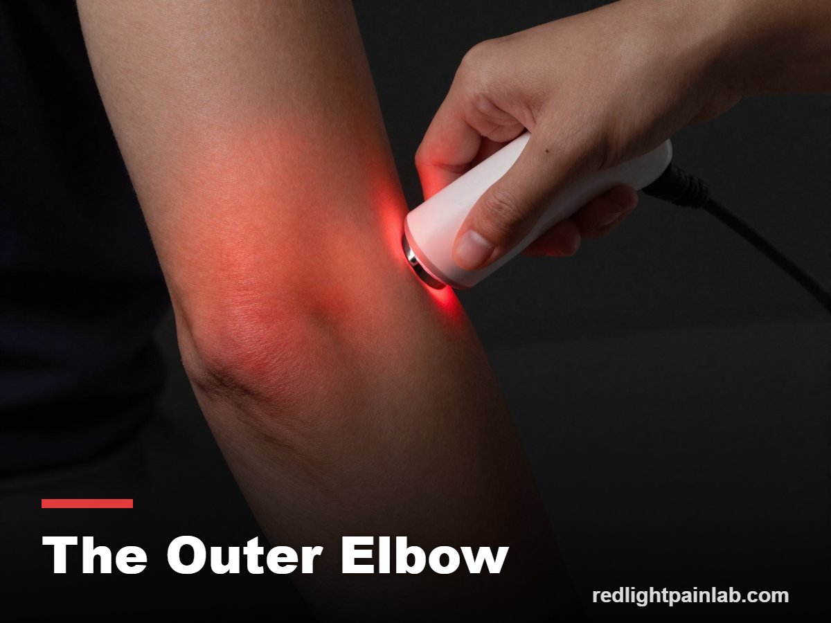 Red light therapy on the outer elbow for tennis elbow