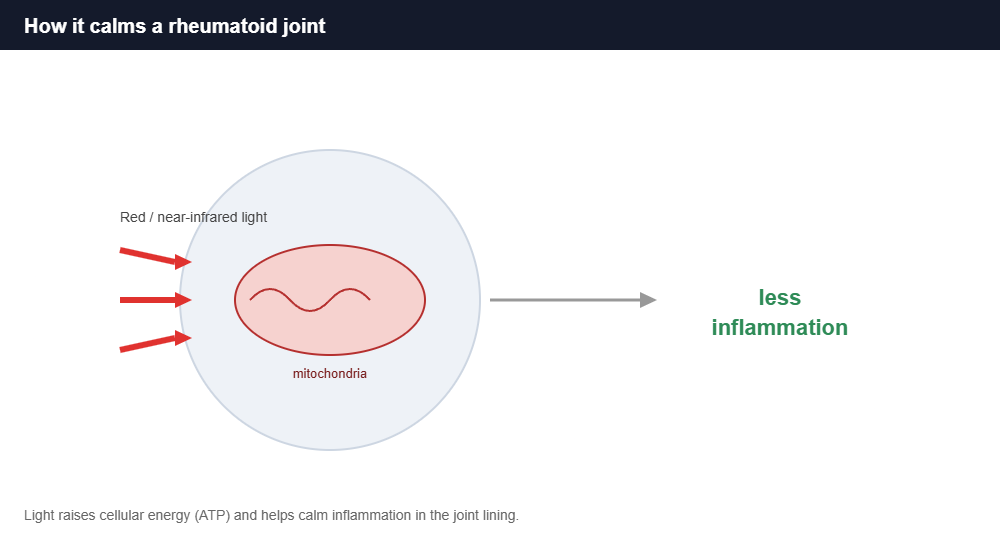 Illustration of red light therapy calming inflammation in a rheumatoid arthritis joint